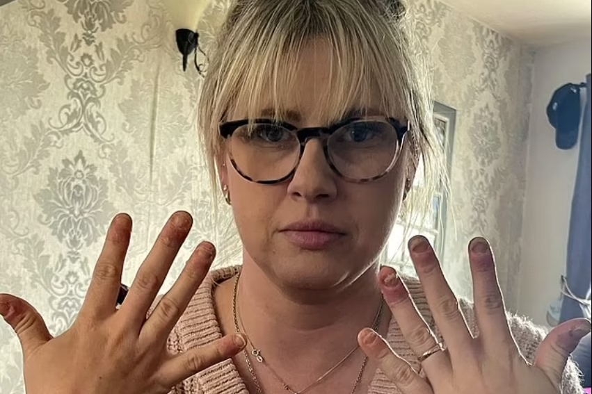 melhores alternativas unhas de gel para alérgicas