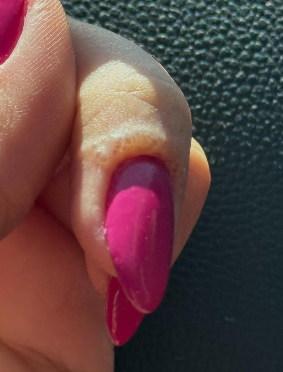 unha de gel causa coceira e vermelhidão