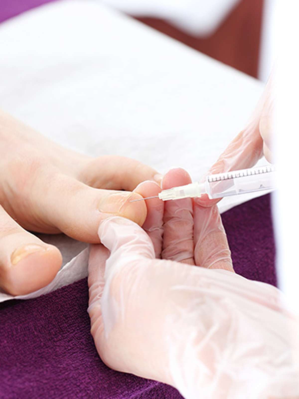 Diferença entre Inflamação e Infecção Bacteriana em Unhas: Um Guia Completo