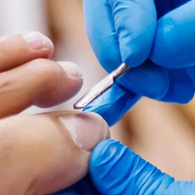 5 ideias de títulos:
1. Unha Inflamada: Guia Completo de Tratamento e Cuidados
2. Como Tratar Pus na Unha: Remédios Caseiros e Medicamentos
3. Unha Encravada: Sintomas