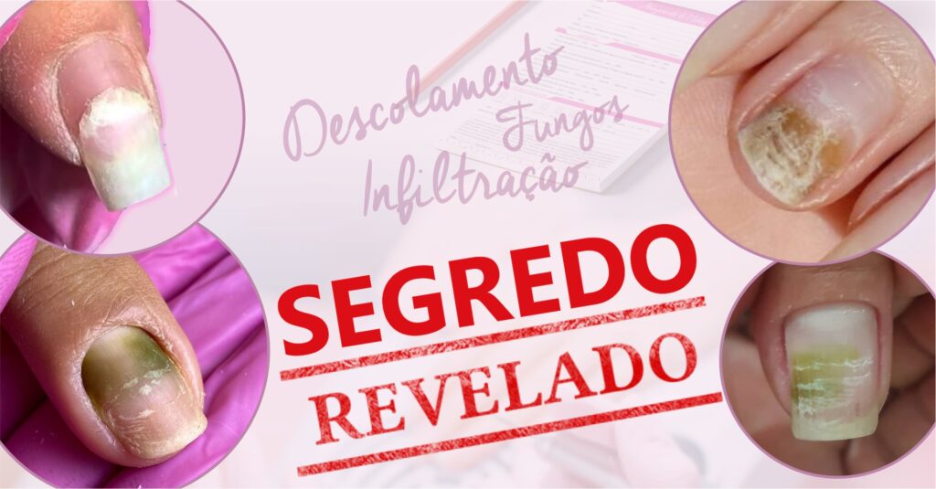 unhas de gel quebram o que fazer