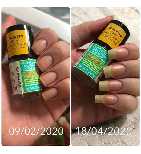 base concreto unha
