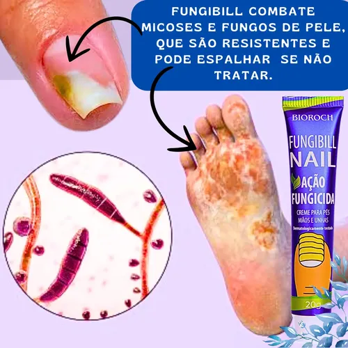 unha do dedo inflamada
