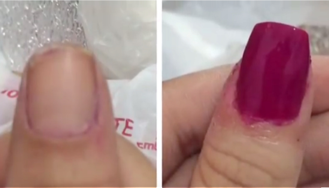 tratamento para unhas fracas em casa