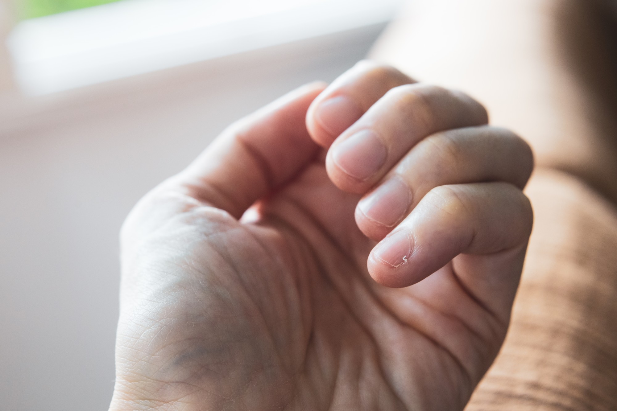 cuidados com unhas quebradiças