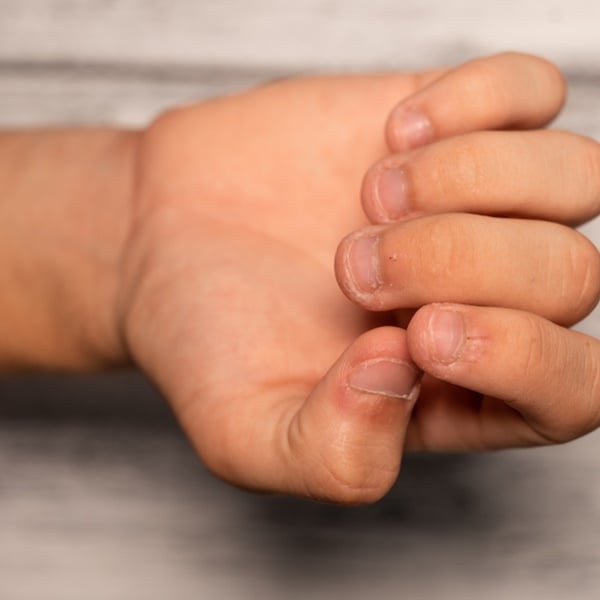 como parar de roer unha