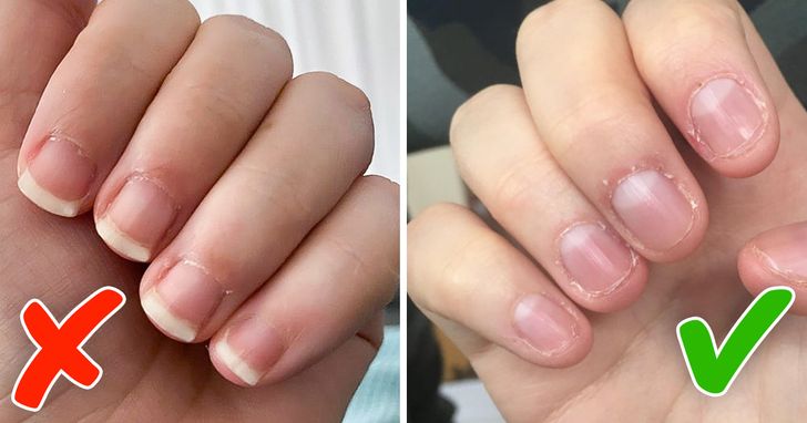 Mavala Stop e Outras Bases: A Solução Amarga para Unhas Roídas; Alongamento de Unhas: Uma Barreira Física Contra a Onicofagia; Ansiedade e Unhas Roídas: Como Identificar e Lidar com os Gatilhos Emocionais; Quando a Onicofagia Vira Compulsão: A Importância da Ajuda Profissional; Dicas Práticas para Deixar de Roer as Unhas de Uma Vez por Todas