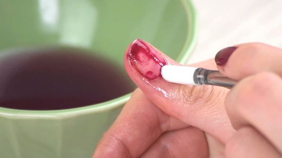 danos causados pela remoção incorreta de gel