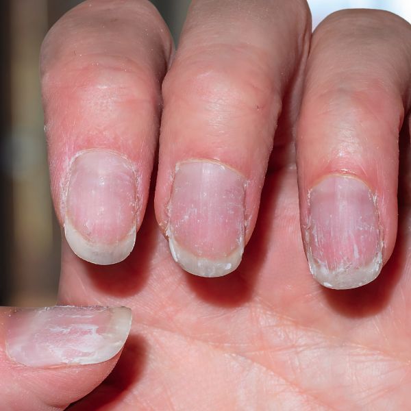 cuidados com as cutículas após remoção de gel