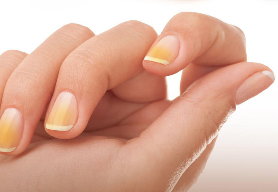 dicas para unhas brancas
