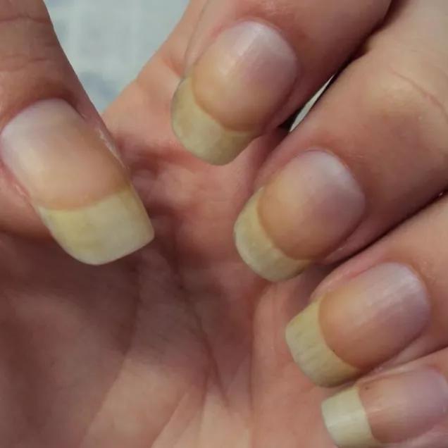 como clarear unhas naturalmente