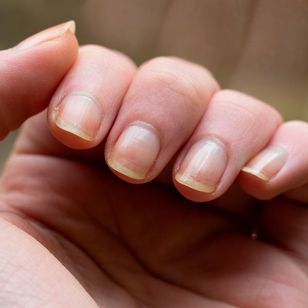 dicas para unhas brancas