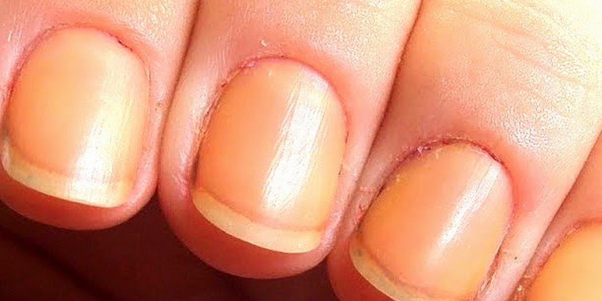 base desamareladora colorama ou blant qual a melhor