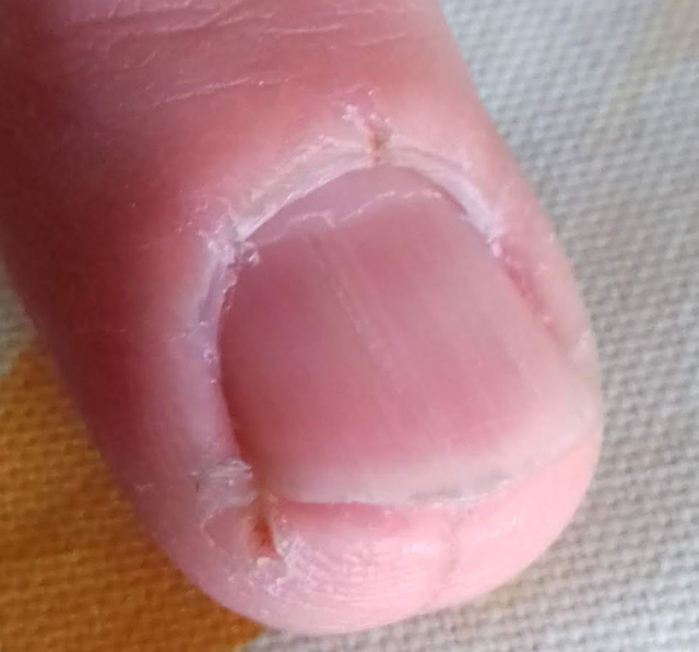 alternativas para remover cuticula