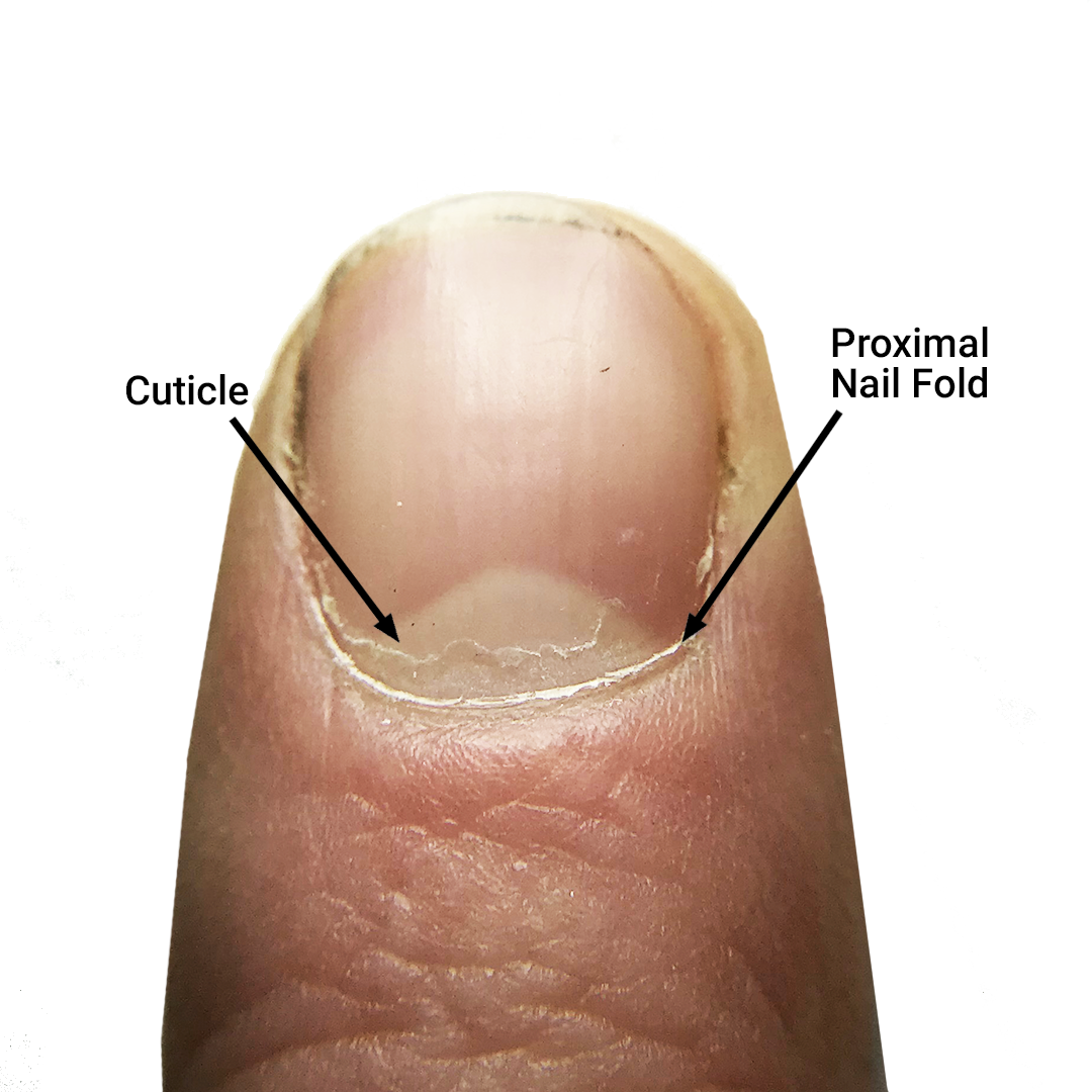 saude da unha e cuticula