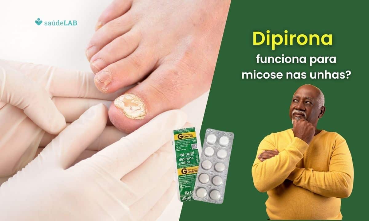 dipirona para unha inflamada