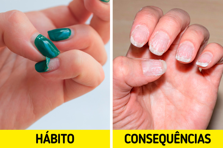 1. Esmaltação em Gel: Mitos e Verdades sobre Danos às Unhas; 2. Guia Completo para uma Esmaltação em Gel Segura e Duradoura; 3. Anvisa e Esmalte em Gel: O Que Você Precisa Saber Sobre Produtos Proibidos; 4. Como Recuperar Suas Unhas Após uma Remoção Incorreta de Gel; 5. Benefícios Reais da Esmaltação em Gel para o Crescimento das Unhas