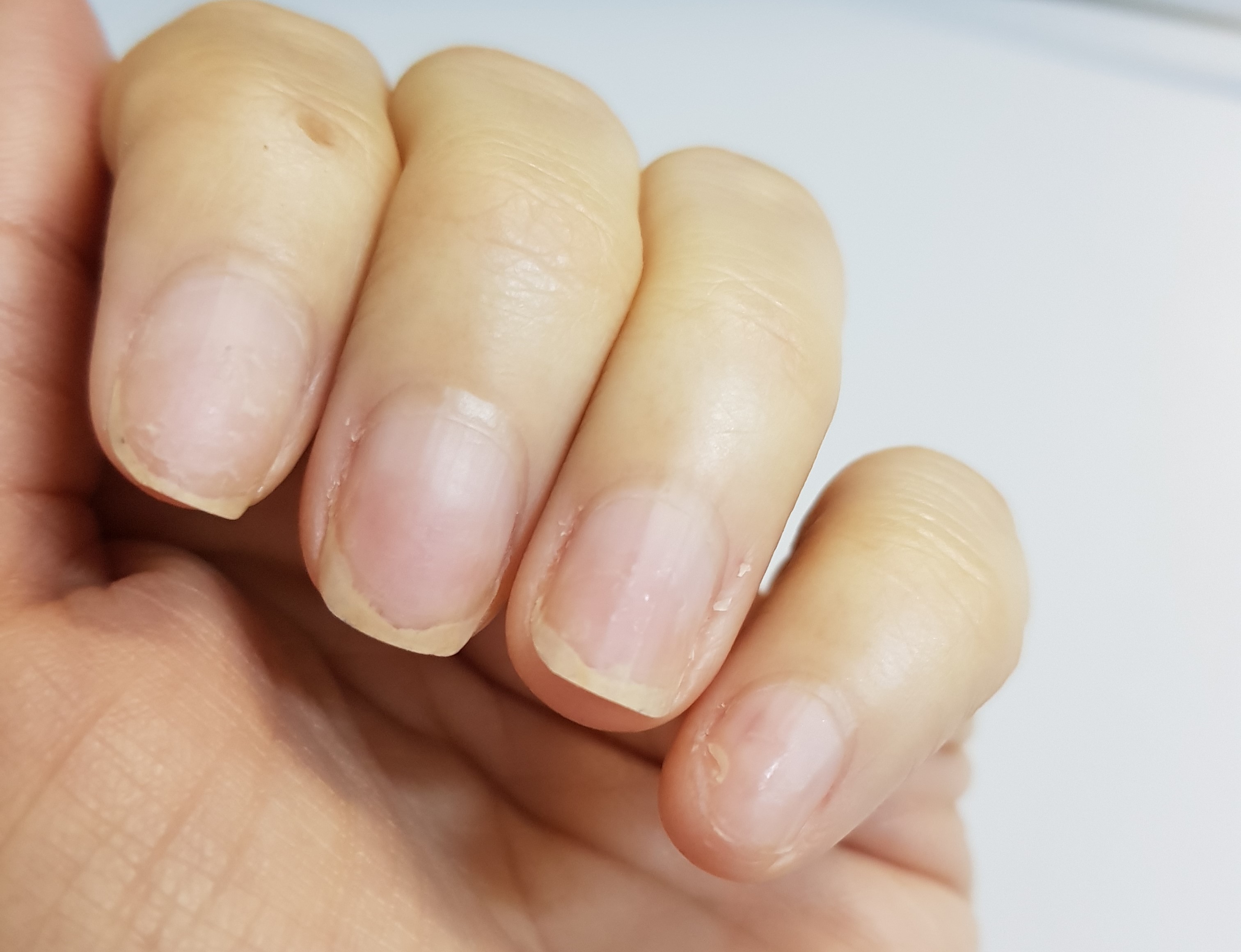 esmaltação em gel estraga a unha