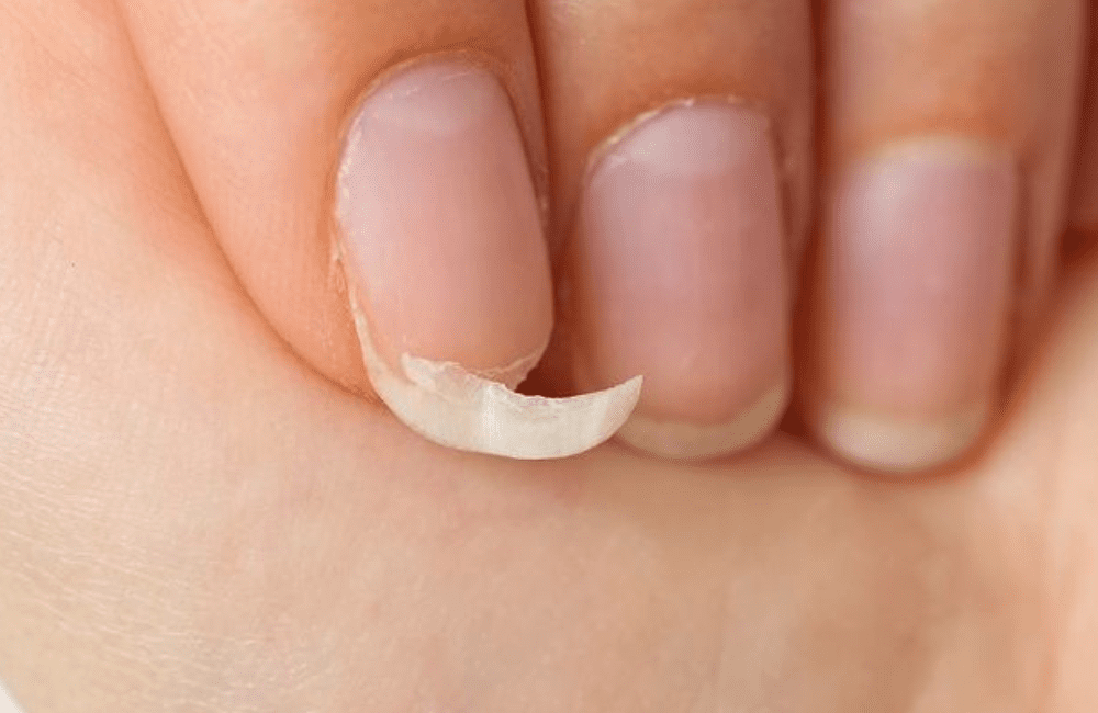 1. Esmaltação em Gel: Mitos e Verdades sobre Danos às Unhas; 2. Guia Completo para uma Esmaltação em Gel Segura e Duradoura; 3. Anvisa e Esmalte em Gel: O Que Você Precisa Saber Sobre Produtos Proibidos; 4. Como Recuperar Suas Unhas Após uma Remoção Incorreta de Gel; 5. Benefícios Reais da Esmaltação em Gel para o Crescimento das Unhas