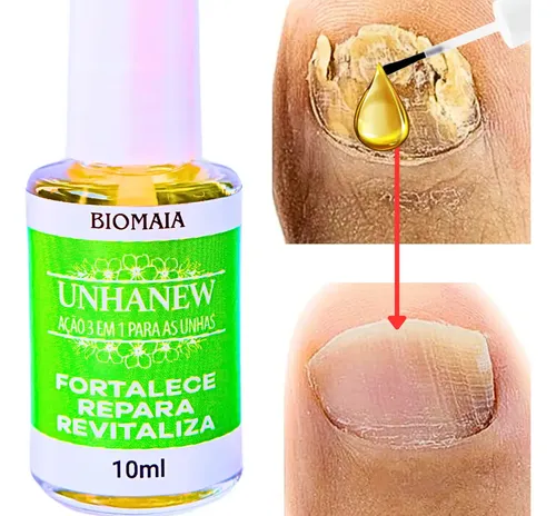 esmalte com ciclopirox olamina