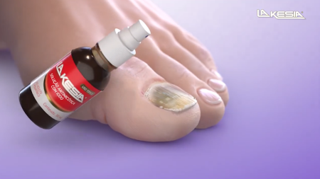 lakesia esmalte