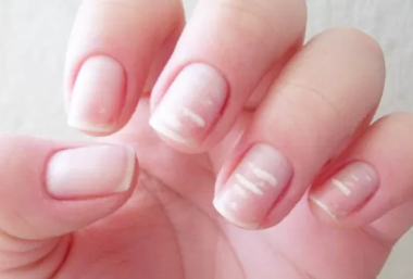 dermatologista unhas