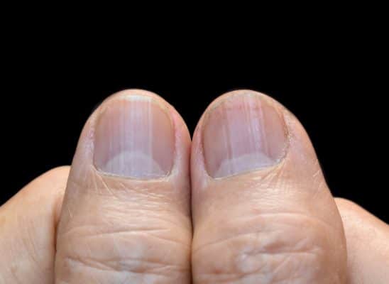 unhas e saúde geral