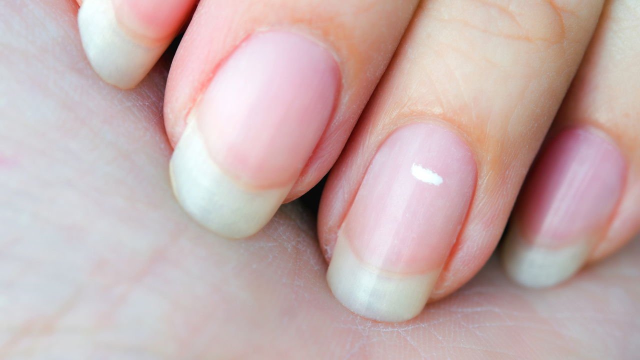 Como prevenir manchas brancas nas unhas: Guia completo
