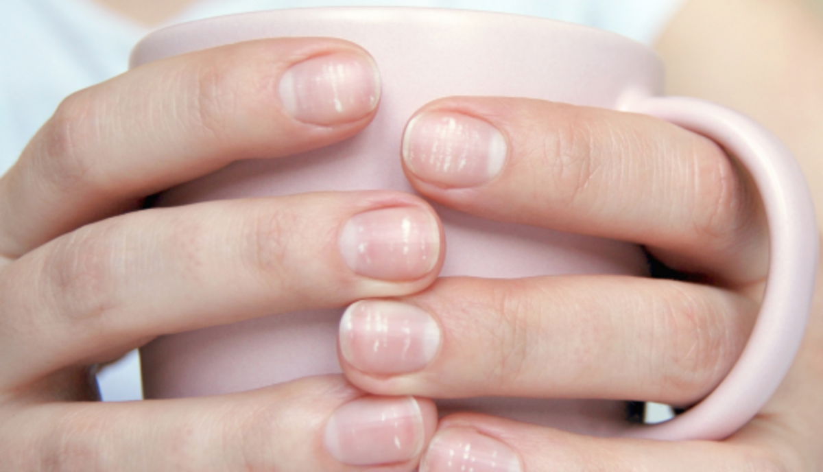 alergia a esmalte