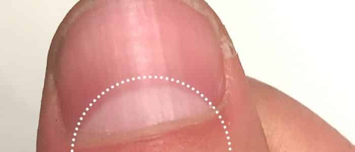 manchas brancas nas unhas das mãos