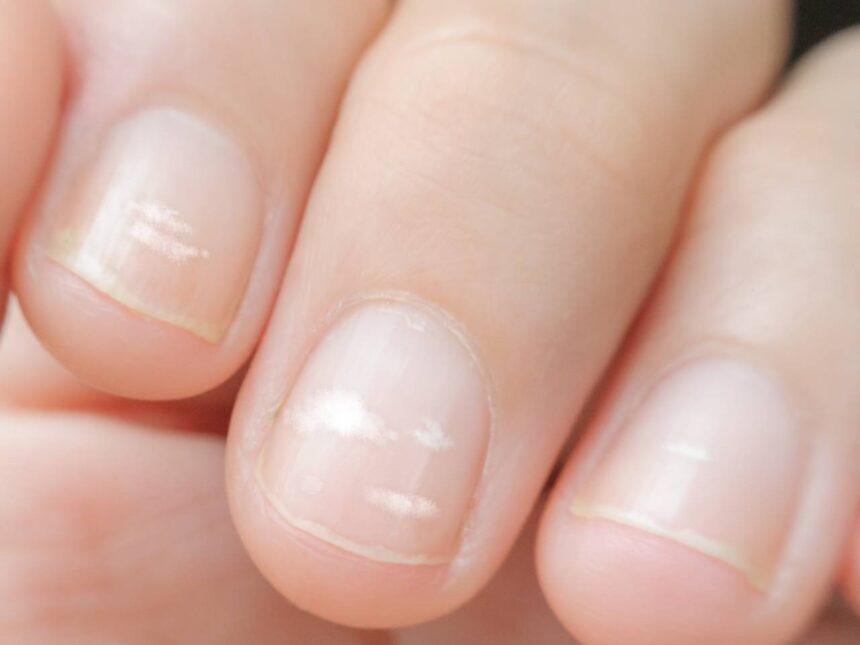 mancha branca na unha significado espiritual