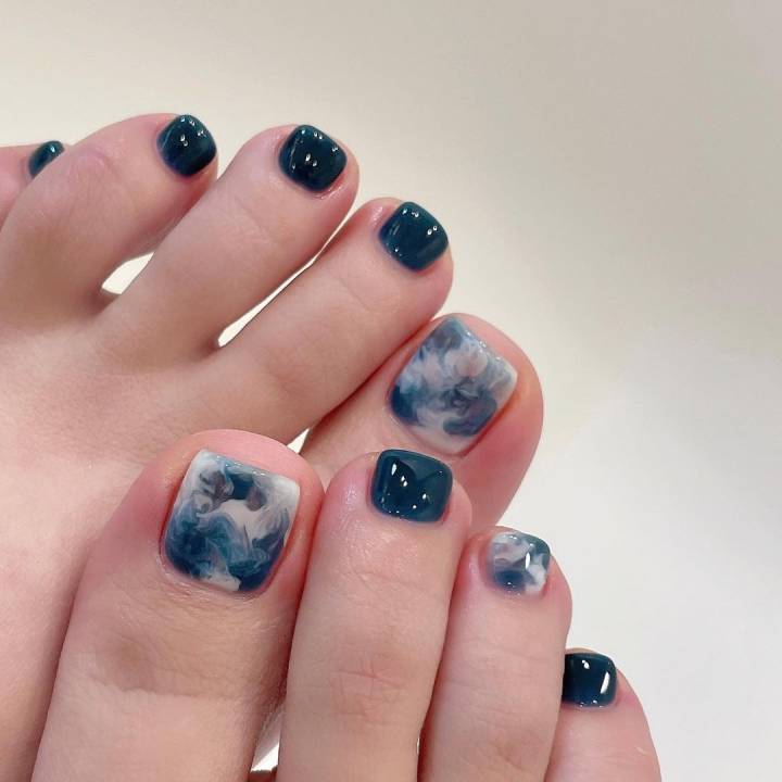 Hematoma Subungueal vs. Melanoma Ungueal: Entenda as Diferenças