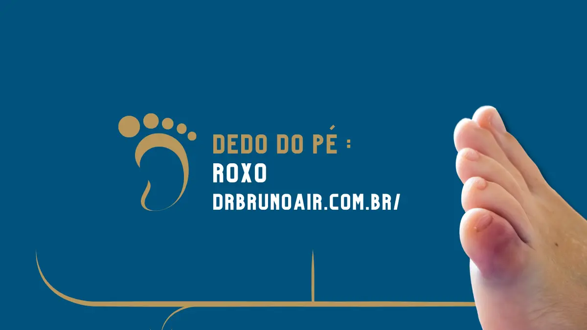 hematoma na unha do dedão