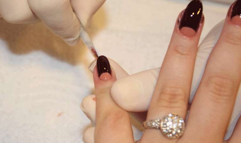 erros comuns ao interpretar a meia lua da unha