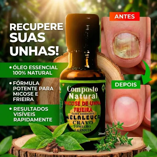 tratamento natural para fungos nas unhas