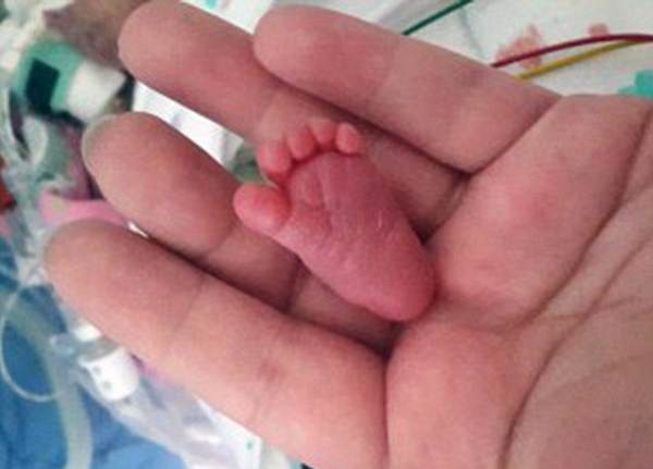 pessoa com unha minúscula