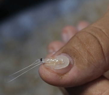 condições genéticas unhas