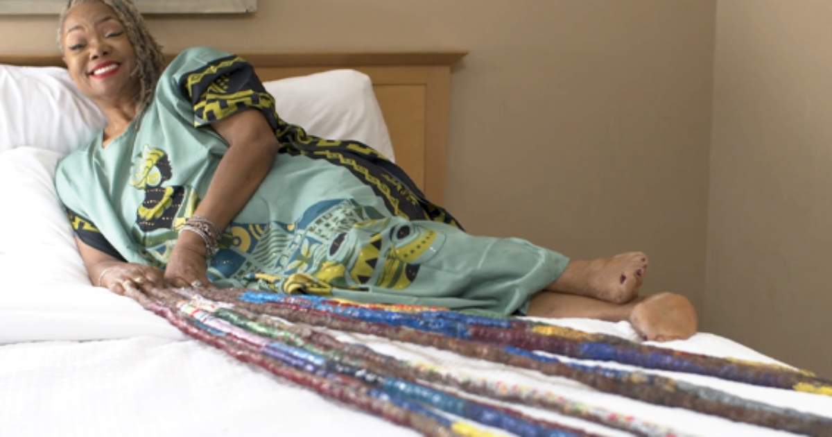 crescimento extremo de unhas