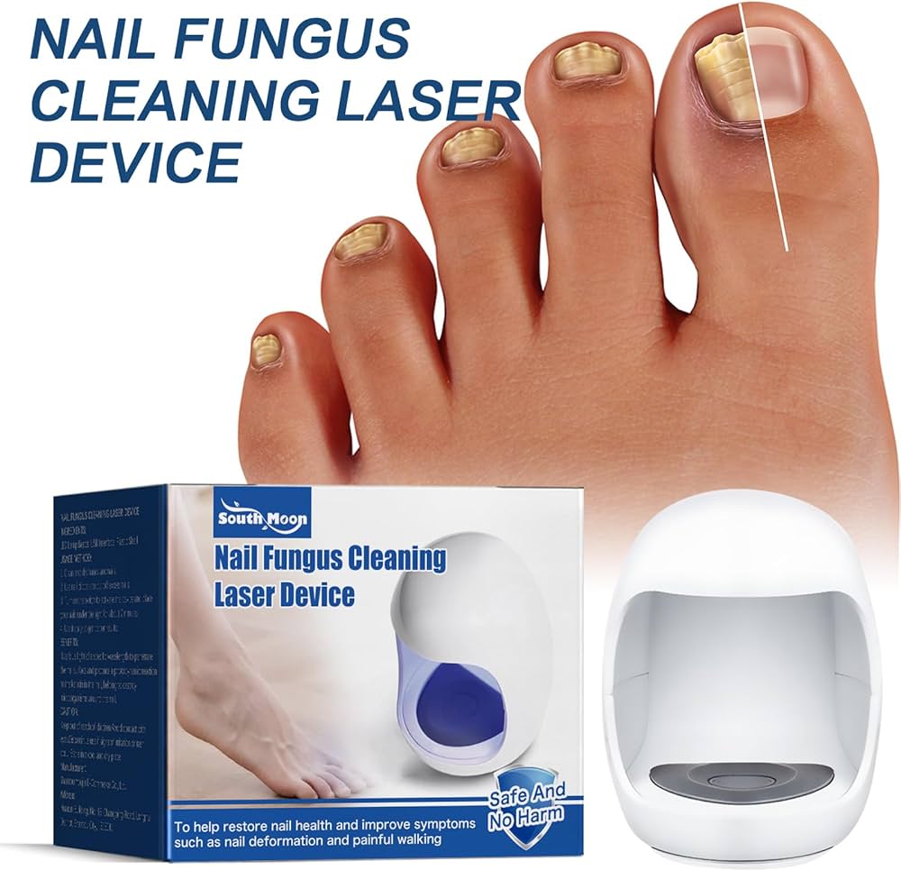 Guia Completo: Como Prevenir e Tratar a Onicomicose