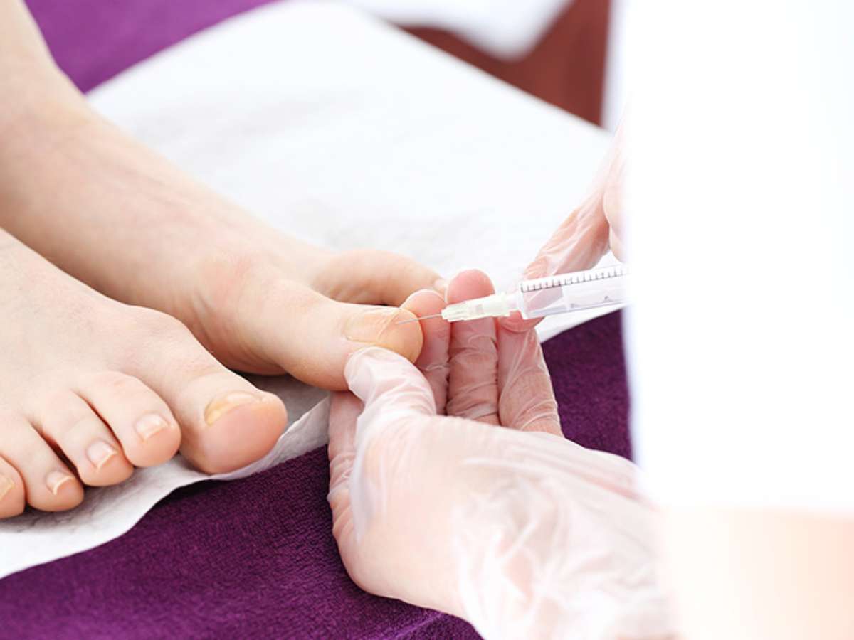 Prevenção é a Chave: Dicas para Evitar que a Unha Inflame Novamente