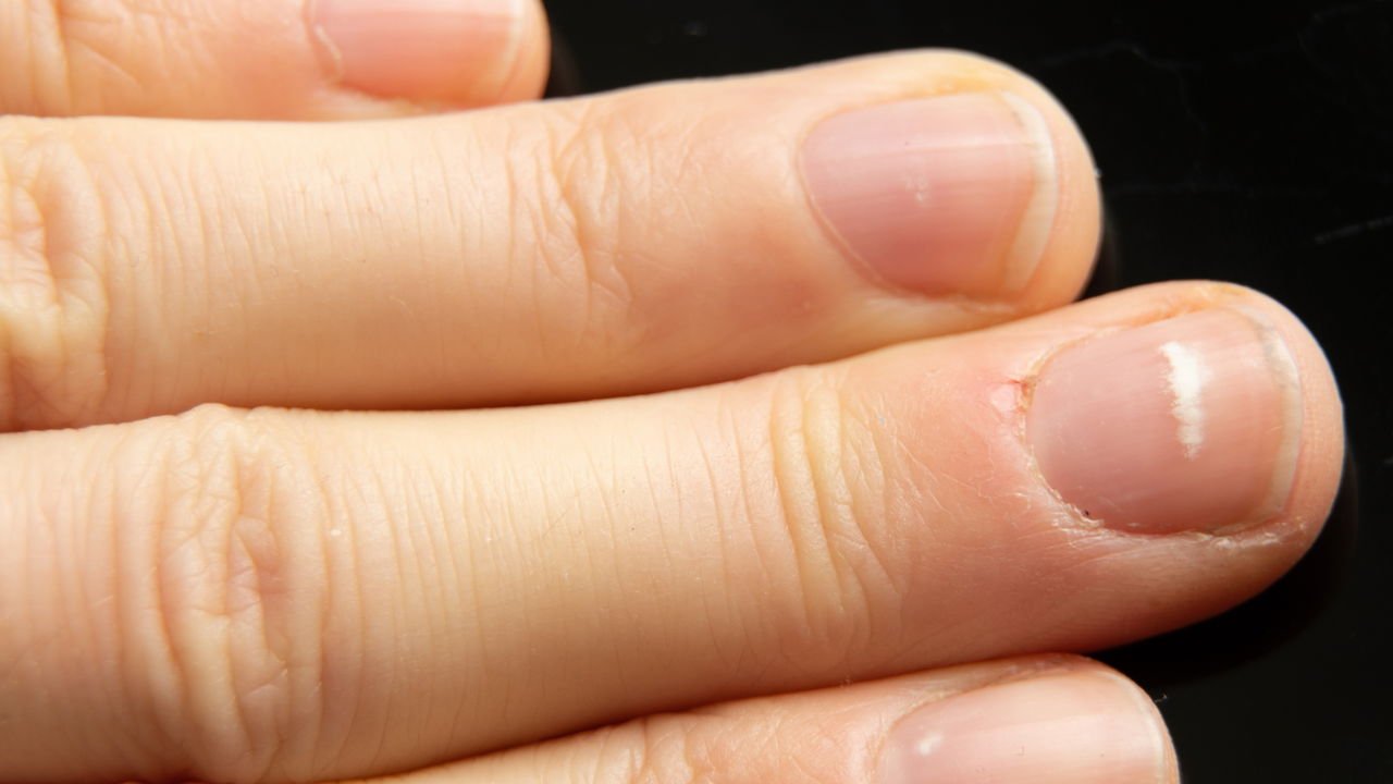 unhas com listras brancas