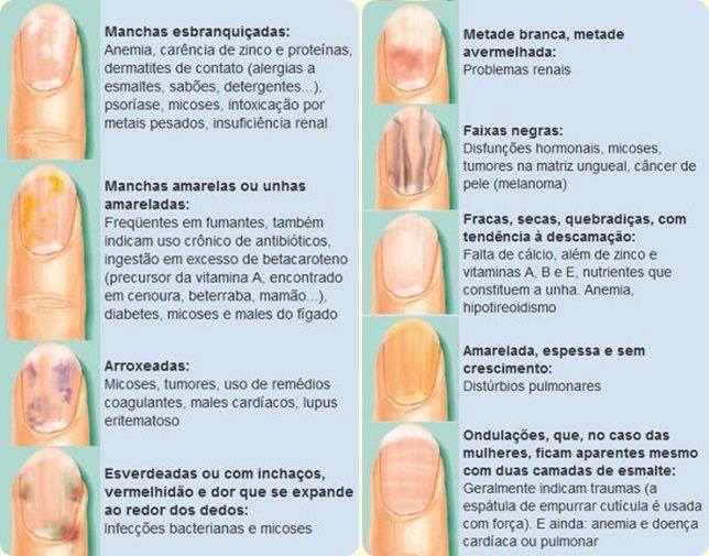 causas de manchas brancas nas unhas
