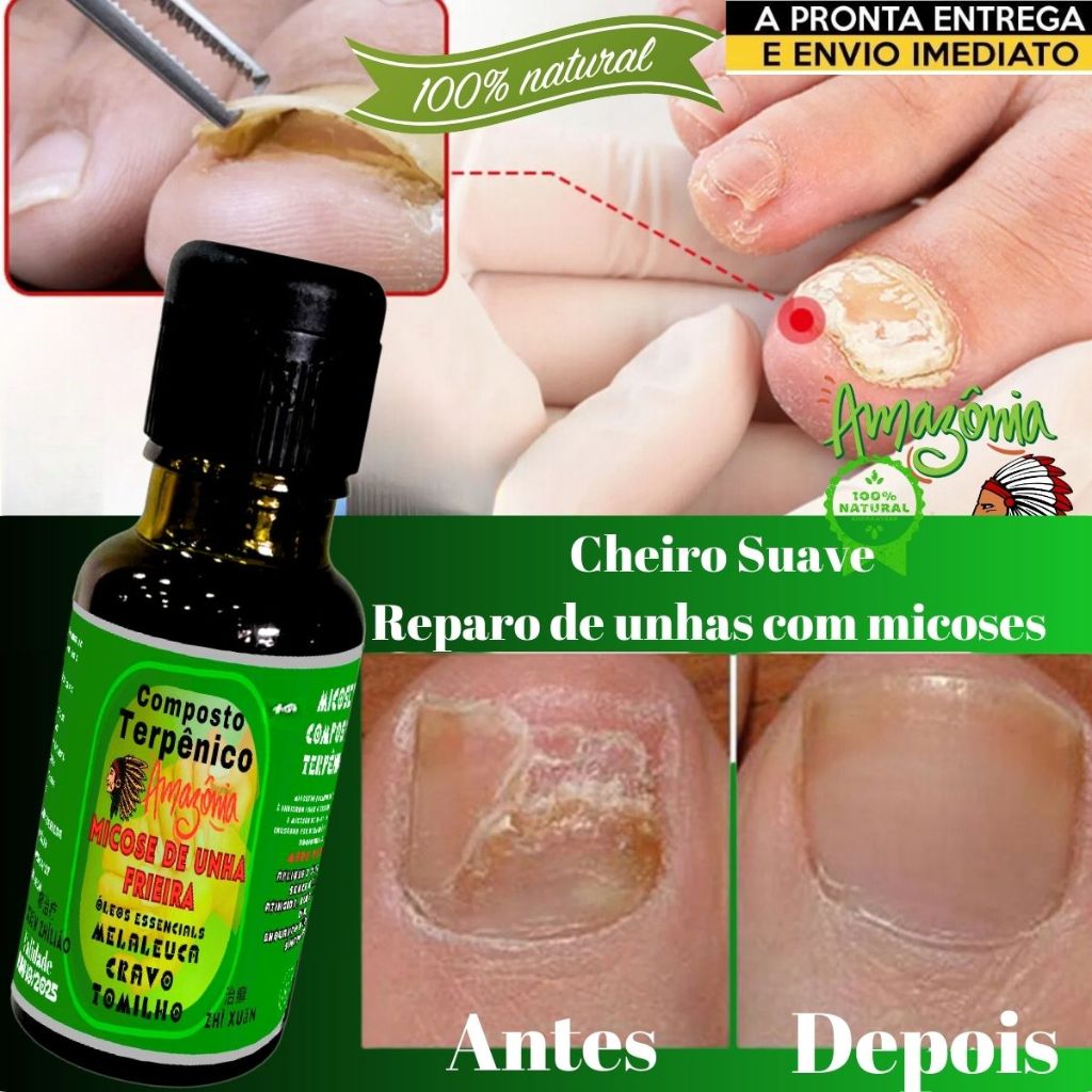 onde comprar óleo de cravo para unhas