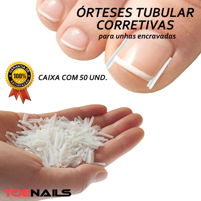 correção de unha