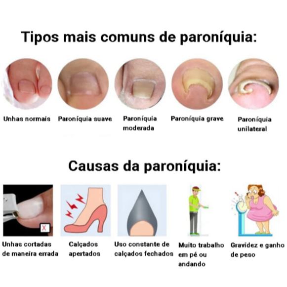 fio ortodôntico unha