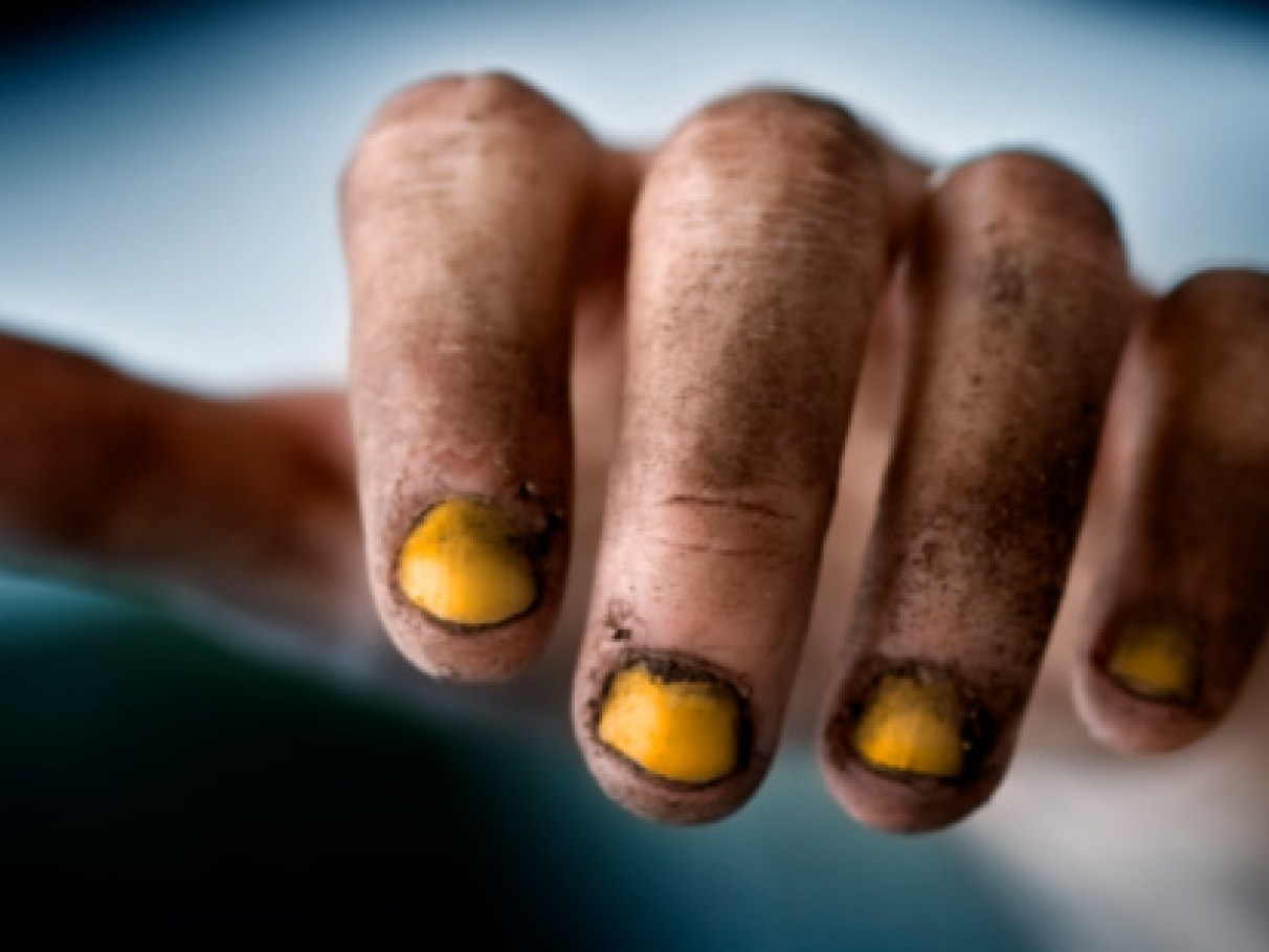 unha de gato para que serve