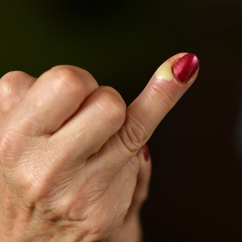 Prevenção de Paroníquia: Dicas para Manter suas Unhas Saudáveis