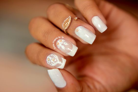 Micoses e Deficiências: As Principais Causas das Manchas Brancas nas Unhas
5. Como Cuidar das Unhas: Prevenção e Tratamento de Manchas Brancas