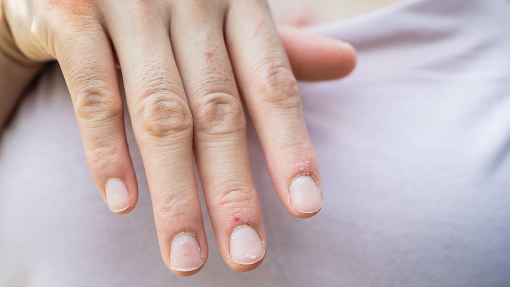 7 sinais nas unhas que você não deve ignorar