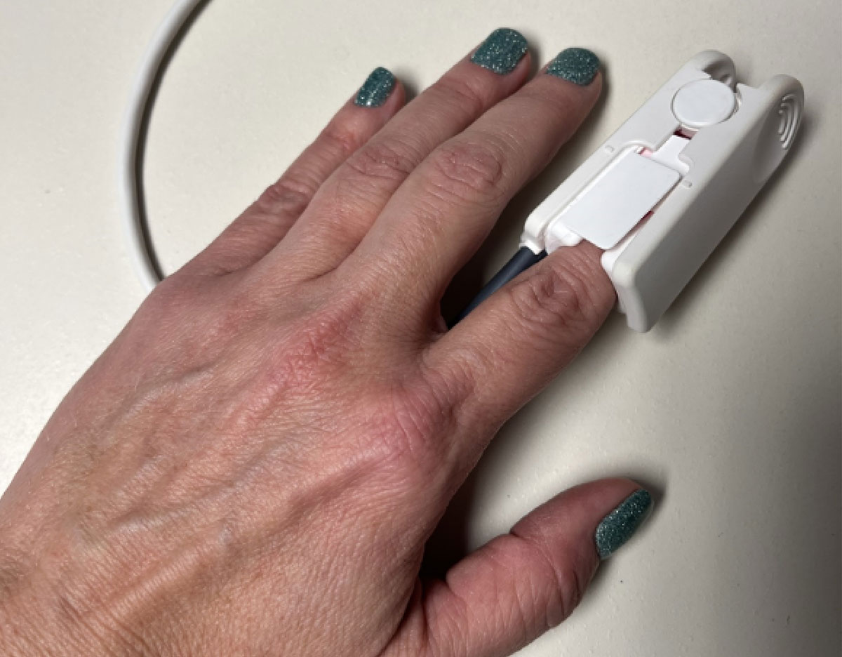 cirurgia com unhas de gel